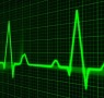 cardiogram